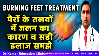 BURNING FEET TREATMENTपैरों के तलवों में जलन का कारण व सही इलाज समझे [upl. by Dimitry]