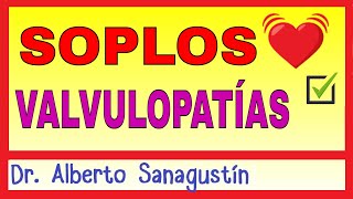 Cómo Memorizar los Soplos y las Valvulopatías Cardíacas [upl. by Ohploda]