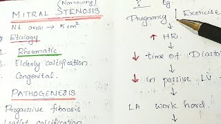 Mitral Stenosis MS Valvular Heart Disease General Medicine [upl. by Nwahsed]