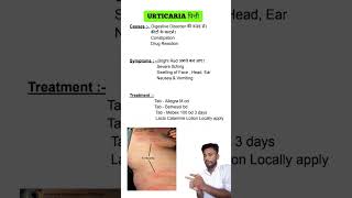 Urticaria  पित्ती causes symptoms and treatment [upl. by Burney]