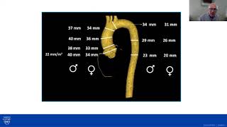 Aorta and Aneurysm Definitions [upl. by Dosia]