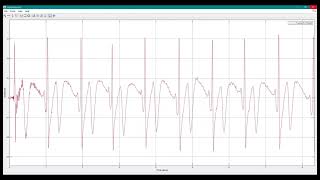 Procesamiento de Señales Electrocardiograficas en Matlab [upl. by Mroz]