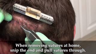 Dr Brett Bolton Suture Removal Short [upl. by Peadar]