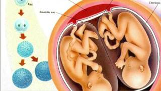 Everything You Need To Know About Fraternal and Identical Twins  Dr Sarah Finch [upl. by Eniotna619]