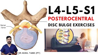 L4L5S1 posterocentral disc bulge exercises  L4L5 and L5S1 central disc bulge treatment in hindi [upl. by Oswin]