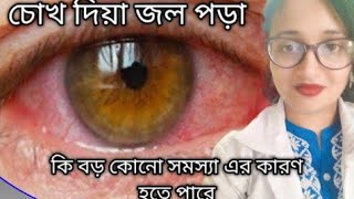 Dry eye Causes amp Treatment in Bengali [upl. by Bria]