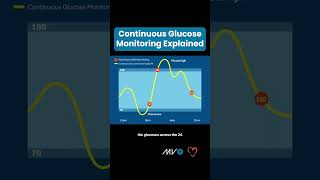 Continuous Glucose Monitoring Explained [upl. by Nauh]