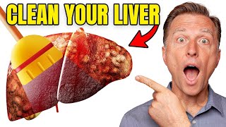 Top BEST Foods to Clean Out Your Liver [upl. by Suirtimed897]