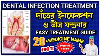 Dental infection treatment in banglaTooth infection treatmentTooth infection medicinedental [upl. by Lenz353]