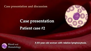 Patient case presentation case 2 [upl. by Mariann620]