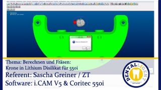 EXOCAD TUTORIAL Teaser  Berechnung – Krone in Lithium Disilikat für Coritec 550i [upl. by Llerat]