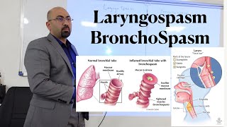 lec LaryngoSpasm amp Bronchospasm [upl. by Nniw364]