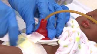 Caring for My Child with a Gastrostomy Tube  St Louis Childrens Hospital [upl. by Alram]