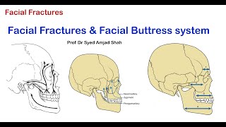 Facial Fractures amp Facial Buttress system  Oral amp Maxillofacial Surgery  Syed Amjad Shah [upl. by Irovi]