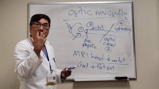 Optic Neuropathy Localization [upl. by Nilpik416]