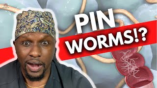 Pinworms Symptoms Treatments and Prevention [upl. by Stafford]