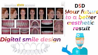 DSD digital smile design in dentistry how to use [upl. by Priebe]