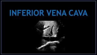 Inferior Vena Cava IVC Echocardiography [upl. by Obellia948]