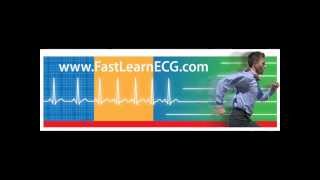 12lead ECGEKG Differentiating between atrial and ventricular arrhythmias [upl. by Sirkin]