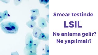 Smear testinde LSIL ne anlama gelir Ne yapılmalı [upl. by Farhsa349]