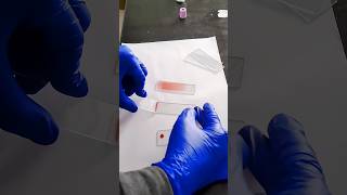 Blood smear preparation  how to make perfect smear shortsfeed shortsvideo [upl. by Ahsiyt809]