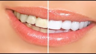 Beauty Tips  Simple steps for at home Teeth Whitening  Beauty Tips [upl. by Sanoj]