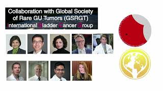 Exploring rare variant subtypes of bladder tumors at BCANs 2023 Think Tank meeting [upl. by Seel]