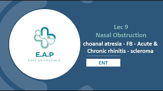 Lec 9  Nasal obstruction  choanal atresia  FB  Acute amp Chronic rhinitis  scleroma  ENT [upl. by Eddra]