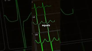 AFib vs AFlutter Know the Signs NOW shorts cardiology [upl. by Anialram]