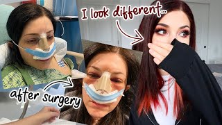 I had to get reconstructive surgery on my face  Kelli Marissa Vlogs [upl. by Rubel409]