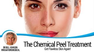 The Chemical Peel Treatment VI Peel featured on CBS Innovations MedSpa [upl. by Arfihs]