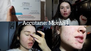 MY ACCUTANE JOURNEY Month 1 Update [upl. by Ruperto800]