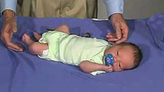 physical exam Newborn Normal Tone  Resting Posture [upl. by Krisha935]