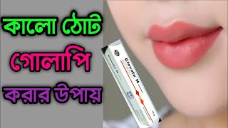 ঠোটের কালো দাগ দূর করার উপায় Tother kalo dag dur korar upay জেনে নিন কালো ঠোট গোলাপি করার ক্রিম [upl. by Huttan]