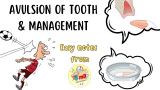 AVULSION  TRAUMATIC INJURIES OF TOOTH  MANAGEMENT endodontics [upl. by Nnail365]