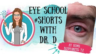 At Home Blepharitis Treatment  SHORTS [upl. by Colon]