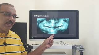 Stylohyoid syndrome Hindi Patient teaching programme [upl. by Nurav]