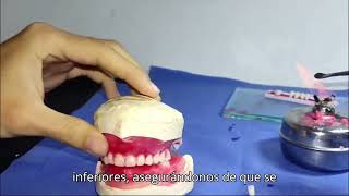 Enfilado dental  Carlos Escorcia  Jennifer Vega [upl. by Davin]