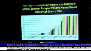 SABCS2012PK1 Judy C Boughey Rochester USA [upl. by Tama]