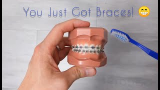 How to care for your new braces and your teeth [upl. by Daye]