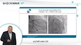 Sneak Peek Shockwave C2 case by Prof Haude amp Dr Golabkesh Calcified LM  LAD  LCX Stenosis [upl. by Irakuy]