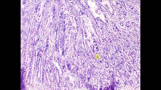 Simple columnar epithelium with goblet cells Duodenum [upl. by Winn980]