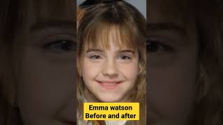 The Evolution of Emma Watson How Shes Transformed Over the Years [upl. by Rianon851]