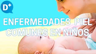 Enfermedades de la piel más comunes en niños [upl. by Erihppas838]