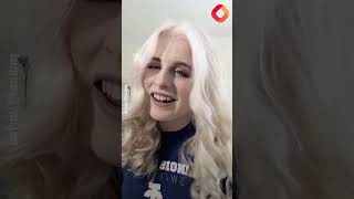 Albino woman becomes viral sensation thanks to violet coloured eyes [upl. by Eelrihs]