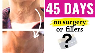 TRANSFORM your wrinkly saggy aging neck🤗 [upl. by Dimmick]