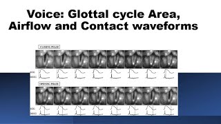 Voice Glottic AreaAirflow and Contact [upl. by Aronle102]