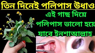 এই গাছ চিনে রাখুন নাকের পলিপাস ভালো করে দিচ্ছে। [upl. by Ahsuatal]