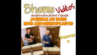 Journal de bord de mon abdominoplastie  partie 2 [upl. by Andee]