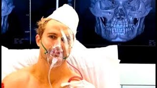 Sage Northcutt vs Cosmo Alexandre Facial bone fracture [upl. by Deloria]